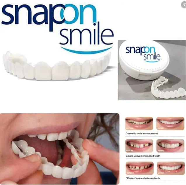 Snap-On Smile Veneers & Transparent Teeth Braces