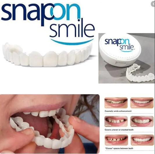 Snap-On Smile Veneers & Transparent Teeth Braces